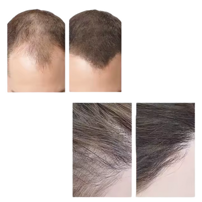 Casquette Thérapie Bicolore LED | Repousse des Cheveux, Cuir Chevelu