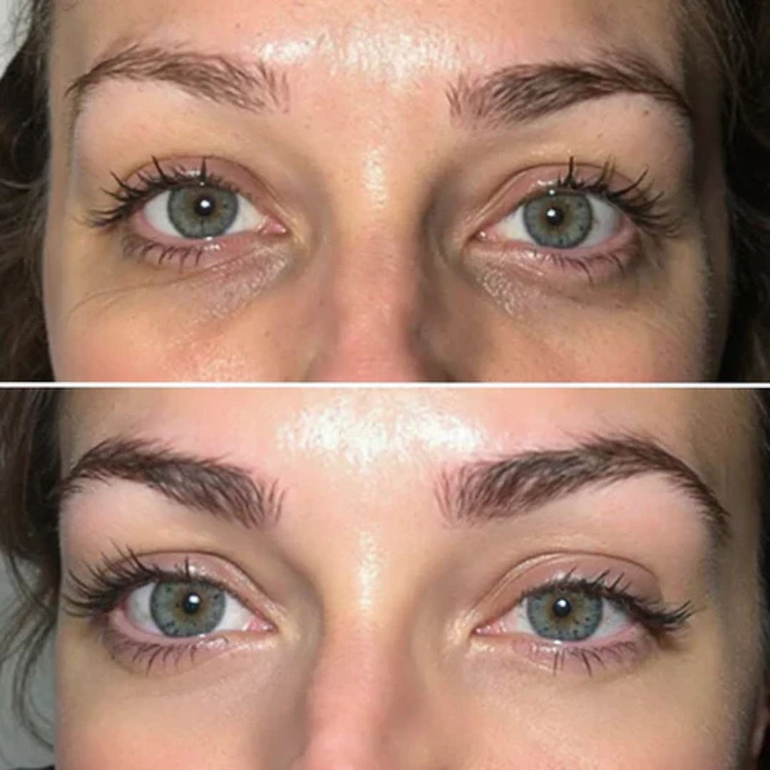 Patchs Contour des Yeux | Anti-Cernes, Défatiguant & Anti-Rides