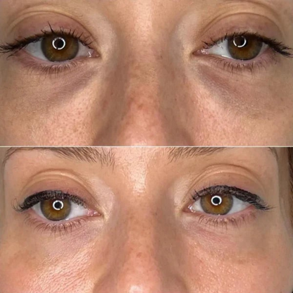 Patchs Contour des Yeux | Anti-Cernes, Défatiguant & Anti-Rides